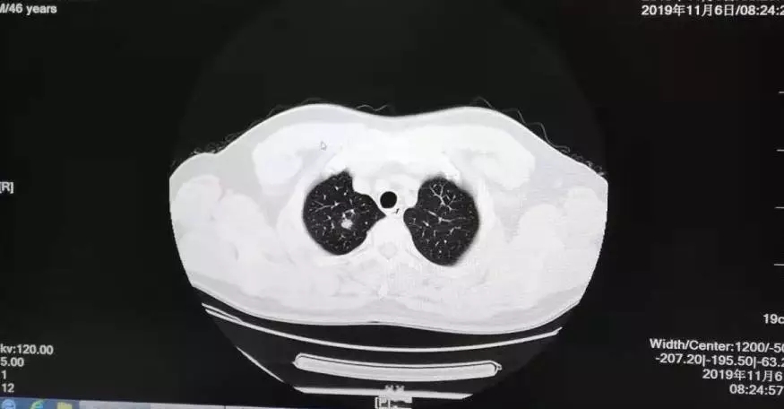 早預防，早發現，早治療 | 浩恩健康體檢十一月重大陽性數據發布